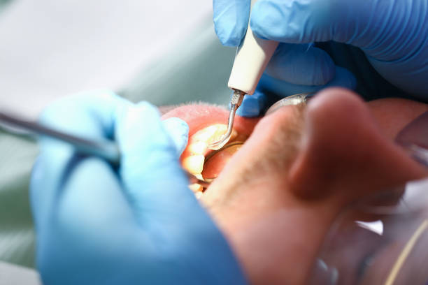 Best Same-Day Emergency Dentist in Hampton, VA